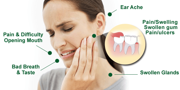 pain in upper jaw wisdom teeth
